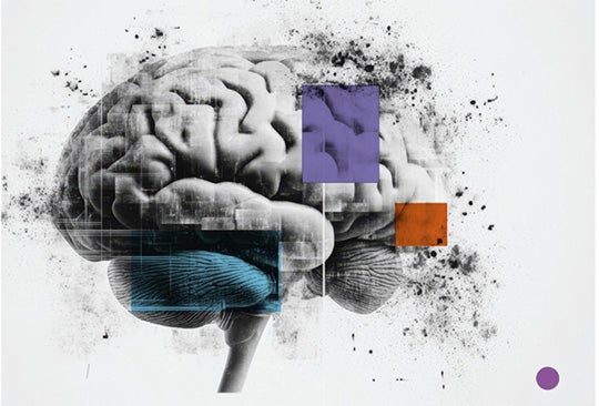 brain_image